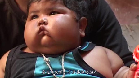 印度最胖女婴，8个月重达40公斤，活成了米其林轮胎人！